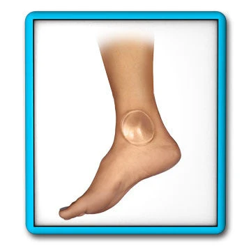 Bunga 2.5" Gel Discs 3 Bunga 2.5" Gel Discs